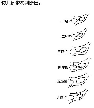 꼉W,Wn,Wvx,W